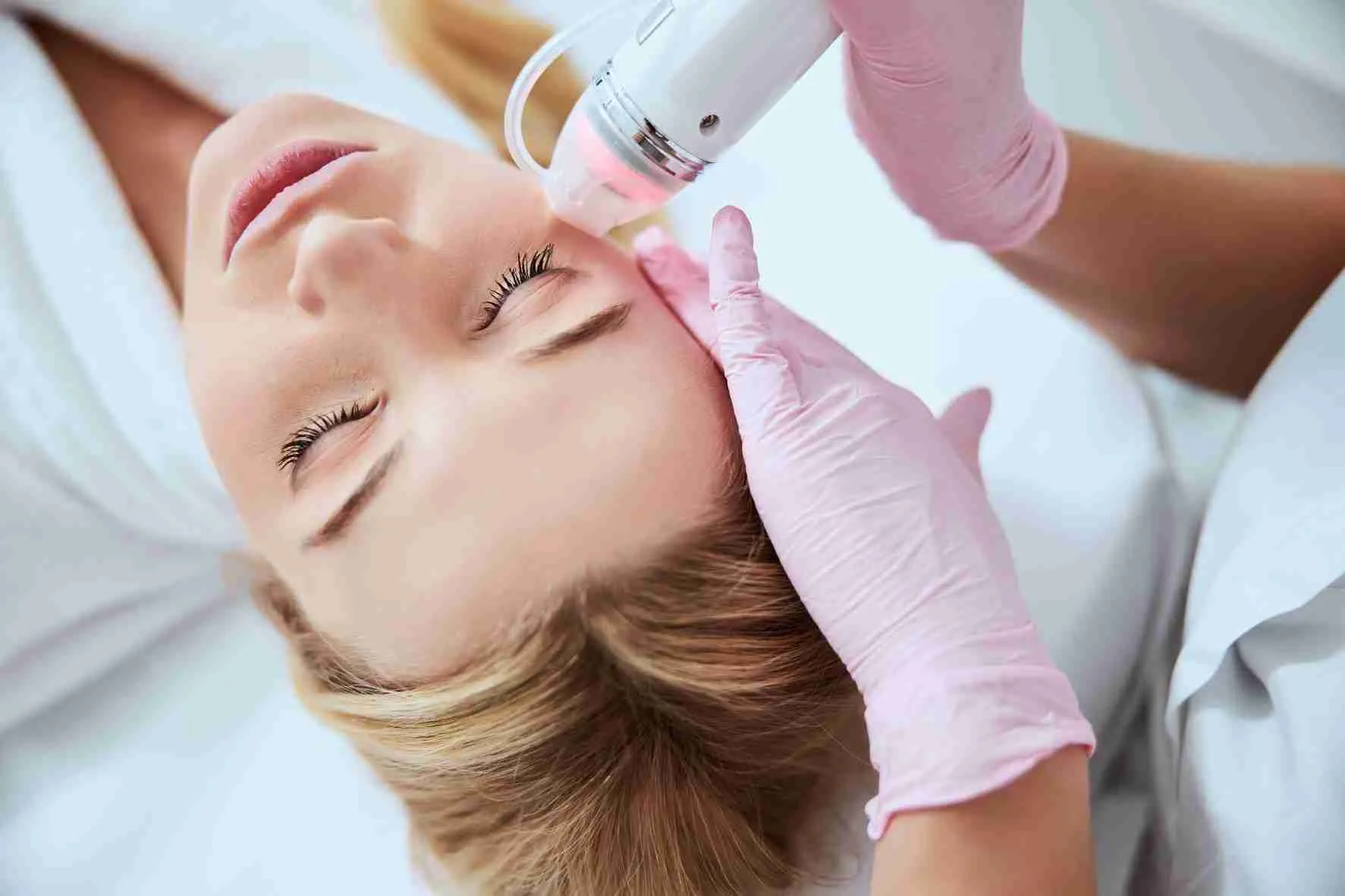 RF MicroNeedling treatment at Essential SkinCare Body Spa in Bonita Springs, Florida